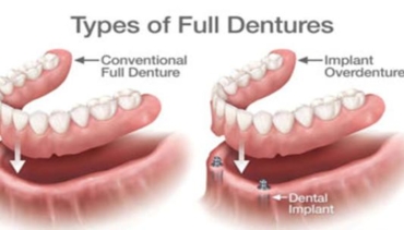 DENTURES