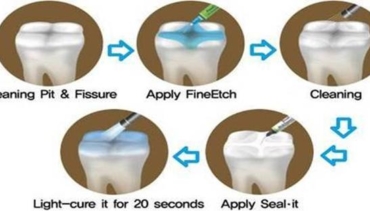 PREVENTIVE DENTISTRY