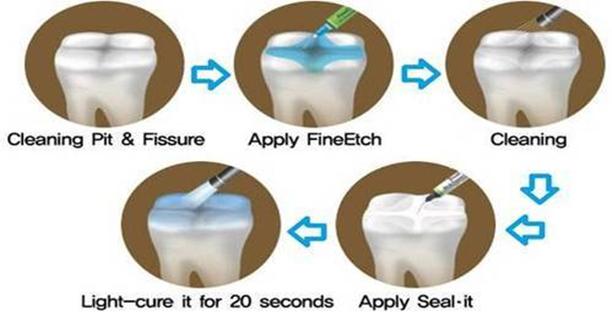 PREVENTIVE DENTISTRY