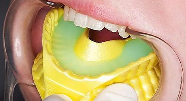 PREVENTIVE DENTISTRY- AS PREVENTION IS ALWAYS BETTER THAN THE CURE