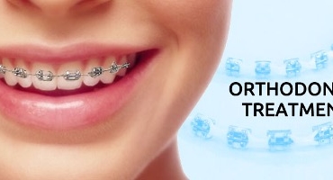 ORTHODONTIC TREATMENT