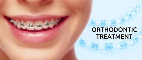 ORTHODONTIC TREATMENT